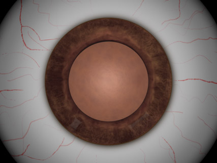 Eye