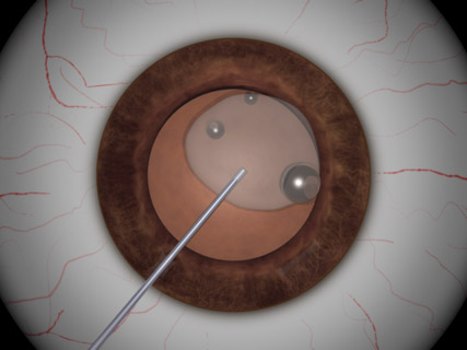 Viscoelastic Bubbles